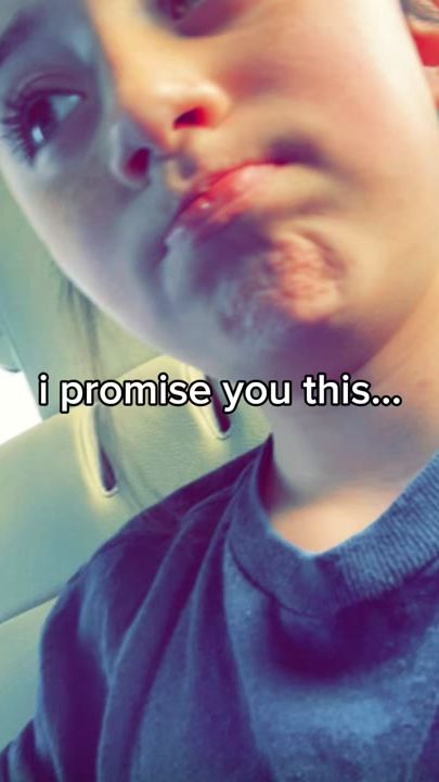 TikTok video thumbnail by imdagoat433