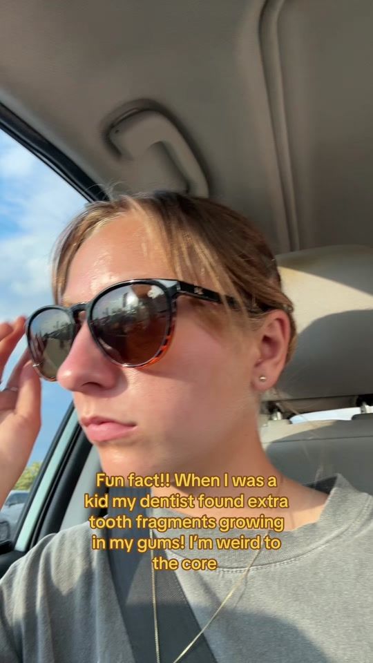 TikTok video thumbnail by vittobeetle