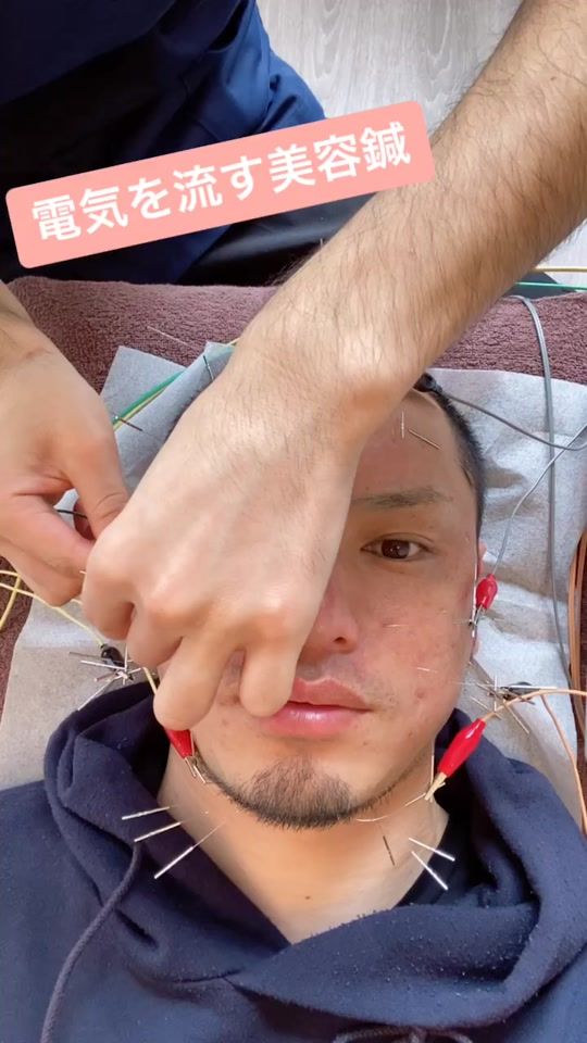 TikTok video thumbnail by interludeplayer