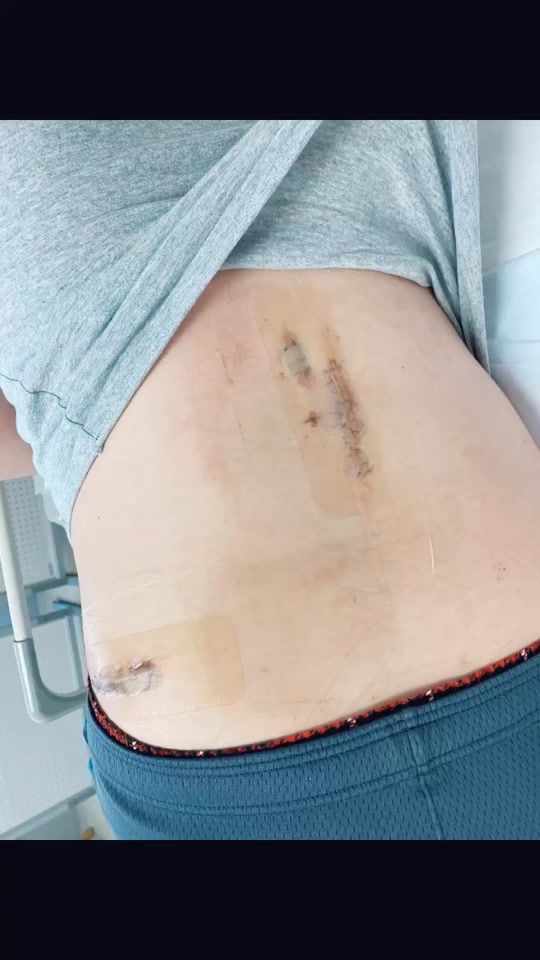 TikTok video thumbnail by takashi0724