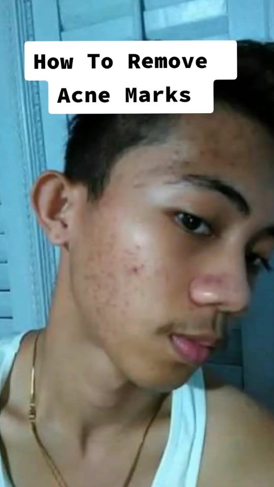 TikTok video thumbnail by baebyboy28